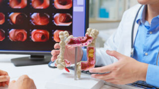 medical consultation - closeup asian male doctor using large intestine model with colonoscopy exam report on computer screen is explaining about colorectal cancer status to patient elderly man